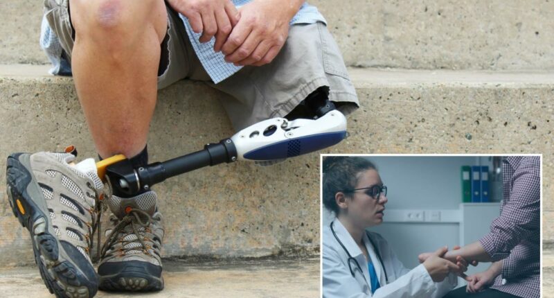 Amputation rates are on the rise â especially among at-risk group